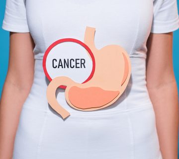 استرس و سرطان معده